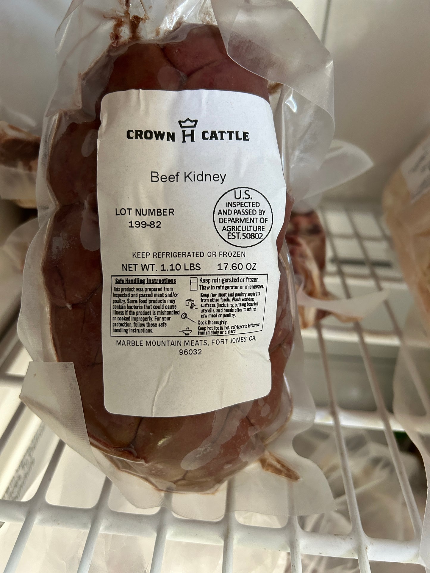 Kidney