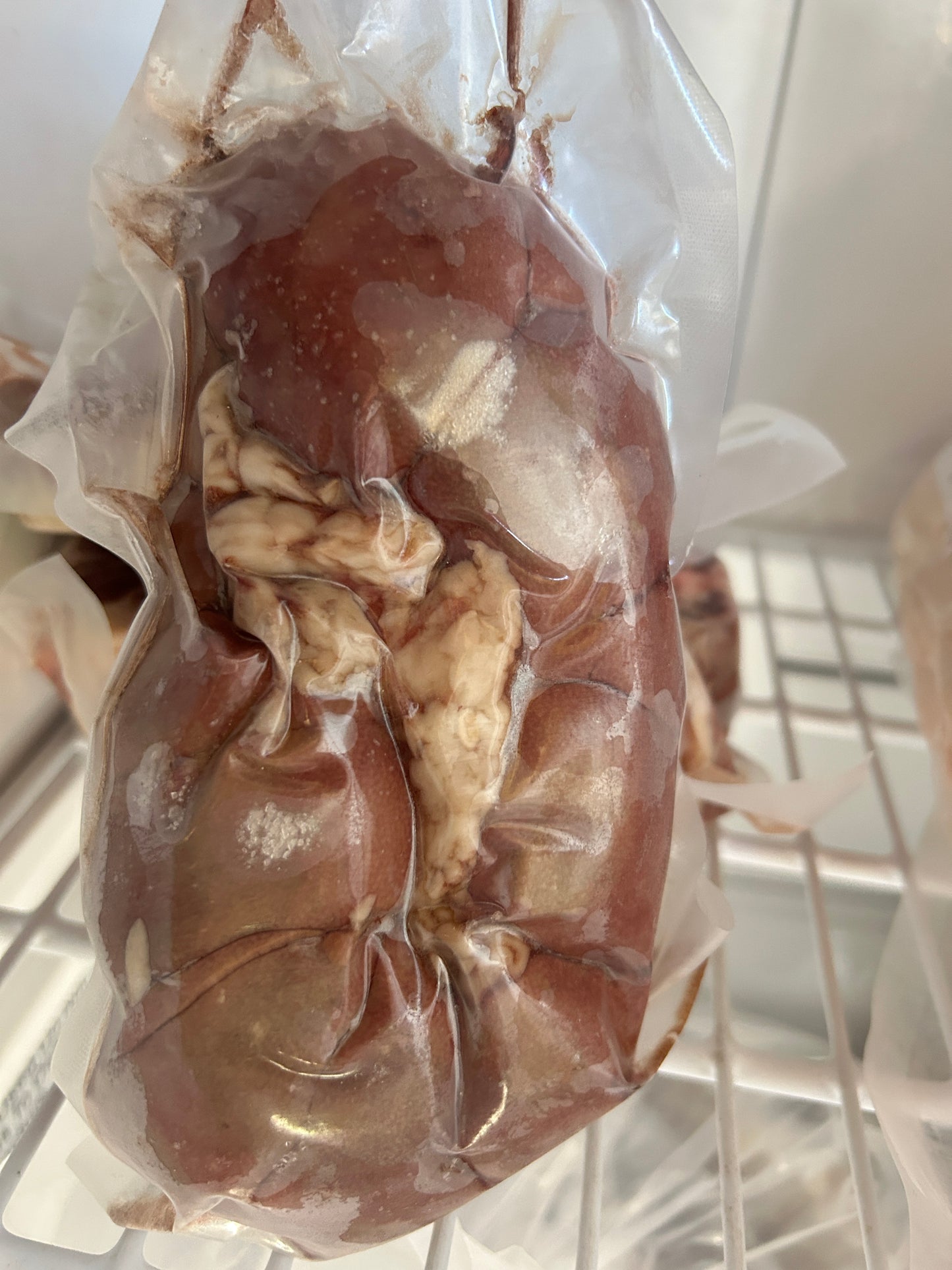 Kidney